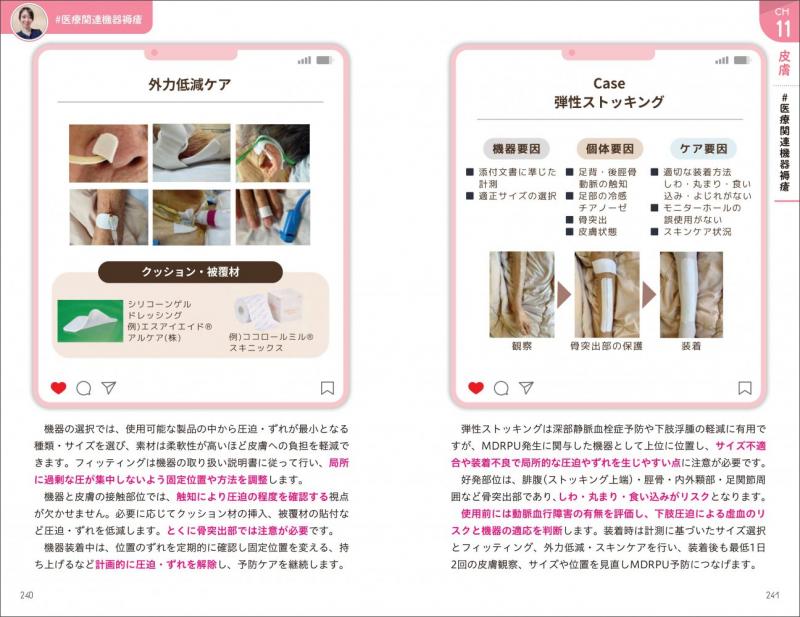 ナース3年目までに知っておきたい！図解でわかるICU看護（松石 雄二朗